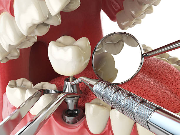 Best Emergency Dental Surgery in Salyersville, KY